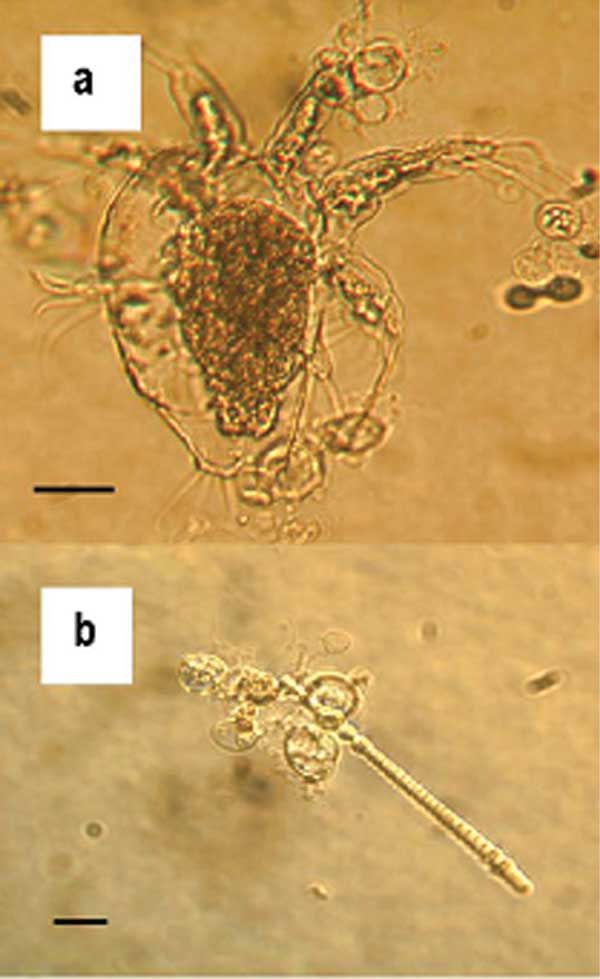 ツボカビ Batrachochytrium dendrobatidis（電子顕微鏡像）